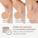 Philips BRI958/00 9000 Series Lumea IPL Hair Removal Device